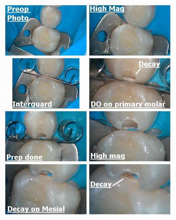 Resize of Class 2s without anesthetic pg 1.jpg